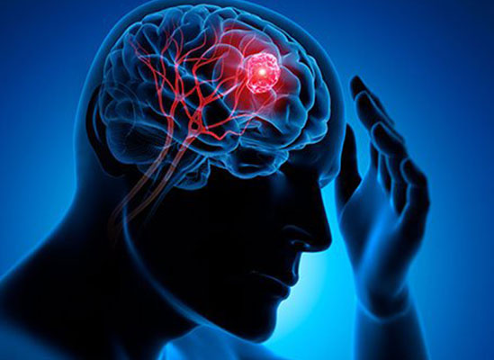 Brain Tumor